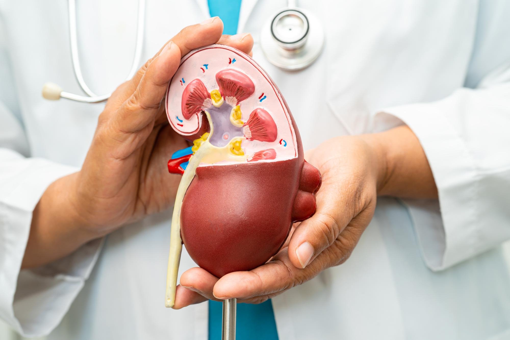 Urology and kidney stone care treatment coordination